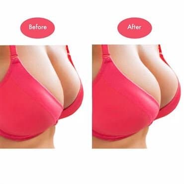 Läpinäkyvä Ovaali Silikonitäyte Rintaliiveihin - 80g