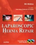 Miniatyrbilde 1 av 2: Laparoscopic Hernia Repair