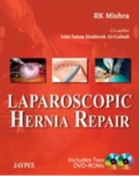 Laparoscopic Hernia Repair