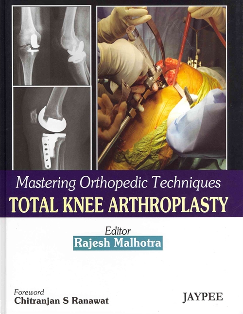 Mastering Orthopedic Techniques