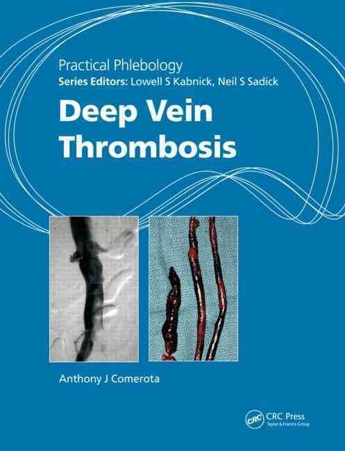 Practical Phlebology