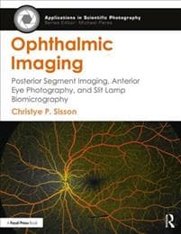 Ophthalmic Imaging