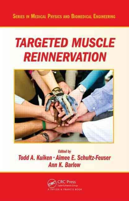 Targeted Muscle Reinnervation