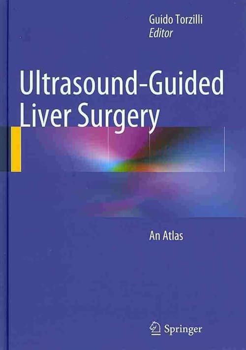 Ultrasound-Guided Liver Surgery