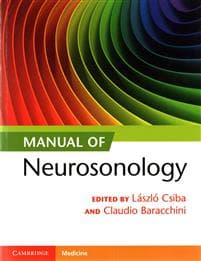 Manual of Neurosonology
