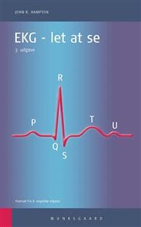 EKG