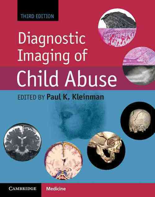 Diagnostic Imaging of Child Abuse