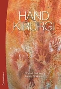 Handkirurgi