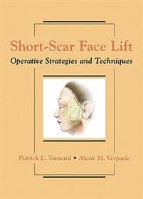 Short-Scar Face Lift