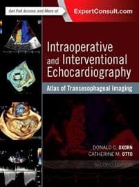 Intraoperative and Interventional Echocardiography