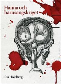 Hanna och barnsängskriget