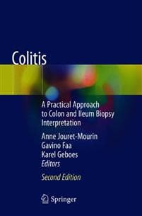 Colitis