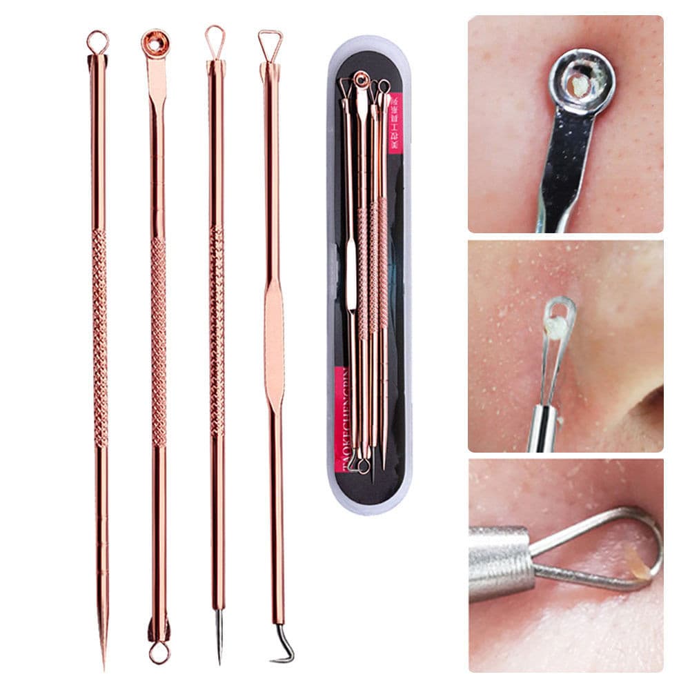 4x Stainless Acne Extractor Remover Blackhead Pimple Needles Blemish Treatments