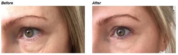 Instant Effects Eye Lift Eye Serum til huden omkring øjnene 8 ml