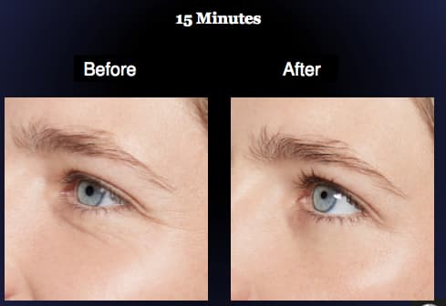 Instant Effects Eye Lift Eye Serum til huden omkring øjnene 8 ml