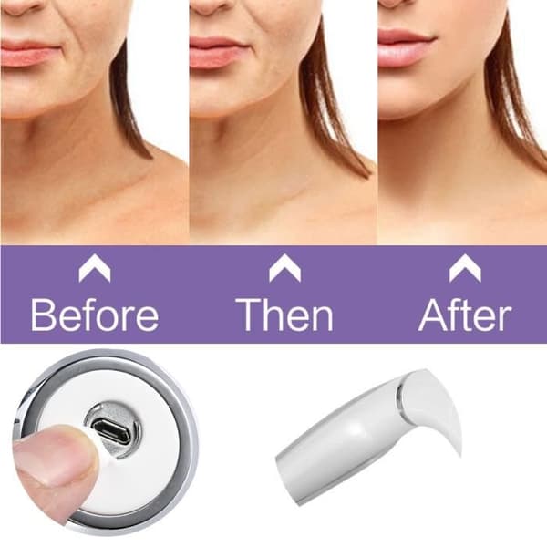 Nackmassager - ZJCHAO - Vibrerande LED - Anti-aging - Anti-rynkor - USB-uppladdningsbar