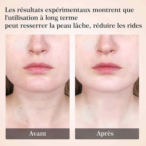 INN Anti Wrinkle Ansiktsapparat Skönhetsanordning Hudvård Skönhetsanordning med lyftande Massage Uppstramande Lyft