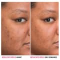 Miniatyrbild 3 av 4: IT Cosmetics Ansiktsvårdsserum Bye Bye Dark Spots Anti-Dark Spots Serum med Niacinamid 30 ml