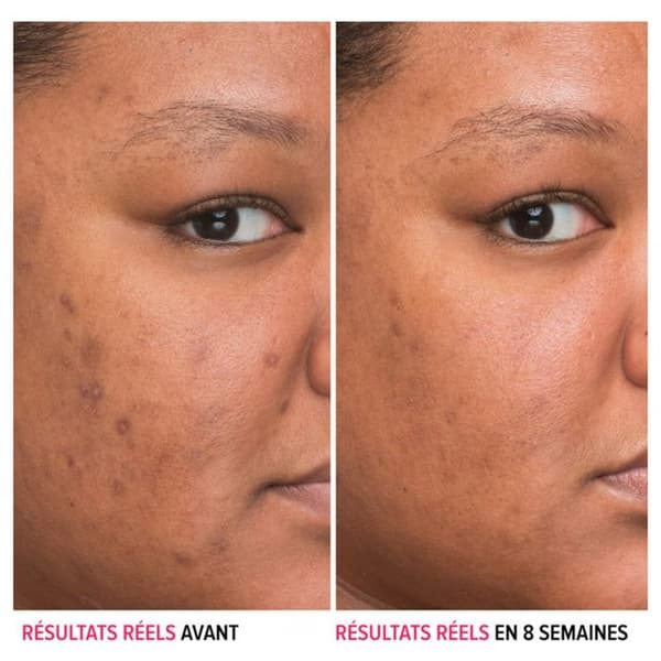 IT Cosmetics Ansiktsvårdsserum Bye Bye Dark Spots Anti-Dark Spots Serum med Niacinamid 30 ml