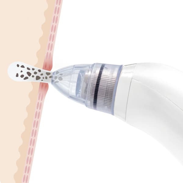 Elektrisk ansiktsrens for hudormer Pore·Off InnovaGoods