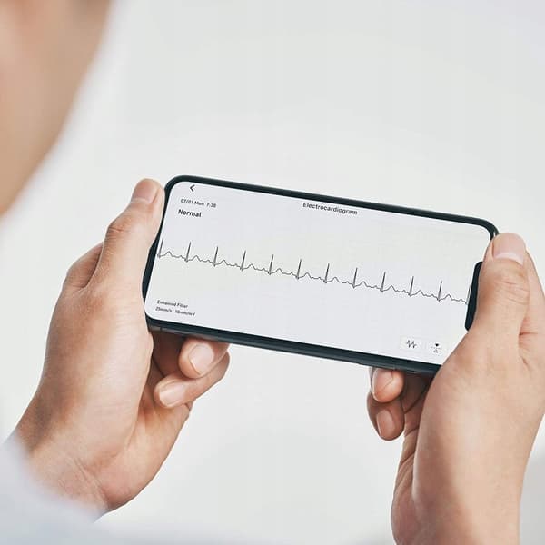 OMRON Täydellinen verenpainemittari ja elektroninen EKG 1 kpl