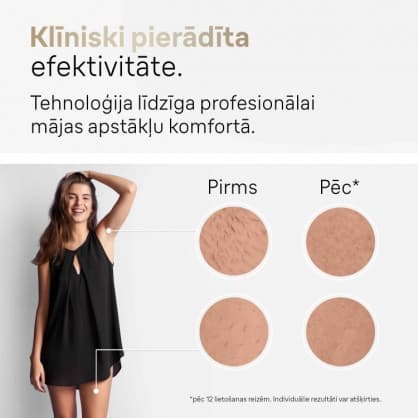 IPL-karvojen poisto, PL5146 Silk-expert Pro 5 IPL, Braun