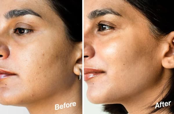 Arden Ceramide Time Complex Capsules 30 Capsules face and throat