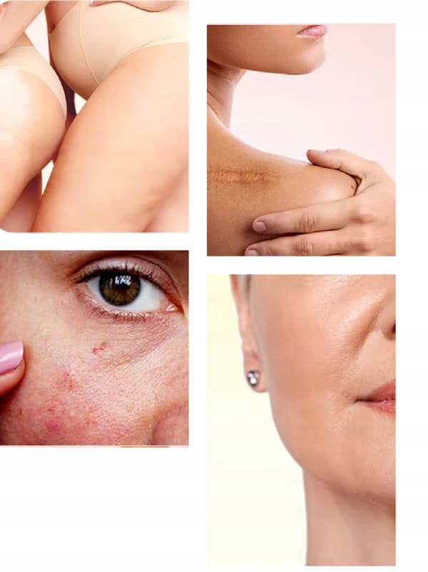 BIO-OIL OIL hudvårdsolja för ÄR OCH STRÄCKMÄRKEN 200 ml