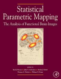 Statistical Parametric Mapping: The Analysis of Functional Brain Images