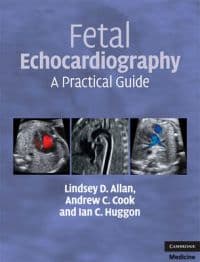 Fetal Echocardiography
