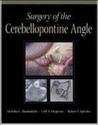 Surgery of the Cerebellopontine Angle