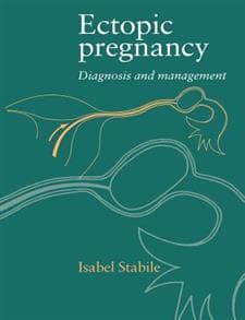 Ectopic Pregnancy