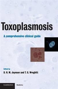 Toxoplasmosis