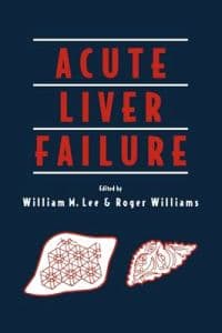 Acute Liver Failure