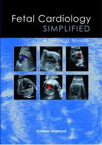 Fetal Cardiology Simplified