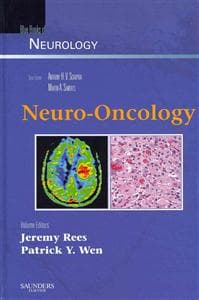 Neuro-Oncology