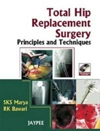 Total Hip Replacement Surgery