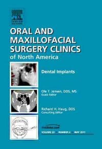 Dental Implants, An Issue of Oral and Maxillofacial Surgery Clinics