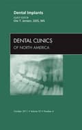 Miniatyrbillede 2 af 2: Dental Implants, An Issue of Dental Clinics
