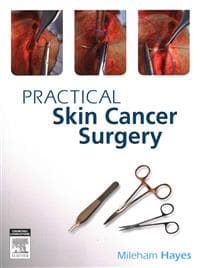 Practical Skin Cancer Surgery