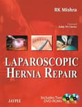 Miniatyrbilde 2 av 2: Laparoscopic Hernia Repair