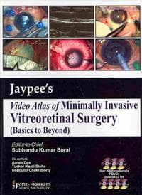 Jaypee’s Video Atlas of Minimally Invasive Vitreoretinal Surgery (Basics to Beyond)