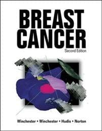 Breast Cancer