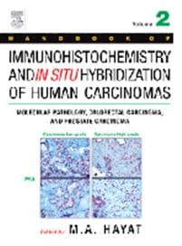 Handbook of Immunohistochemistry and in Situ Hybridization of Human Carcinomas