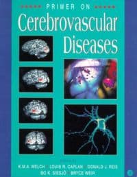 Primer on Cerebrovascular Diseases