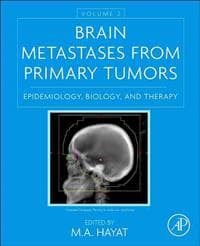 Brain Metastases from Primary Tumors, Volume 2