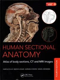 Human Sectional Anatomy