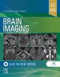 Brain Imaging