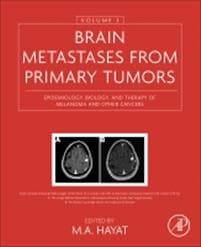 Brain Metastases from Primary Tumors, Volume 3
