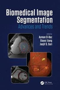 Biomedical Image Segmentation